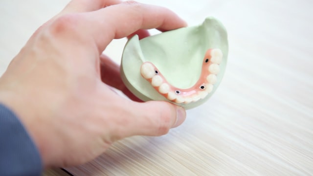 How to Clean Your Retainer